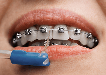 Ortodontik Tedaviler